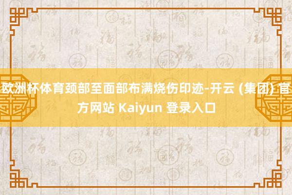 欧洲杯体育颈部至面部布满烧伤印迹-开云 (集团) 官方网站 Kaiyun 登录入口